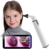Wireless Otoscope Ear Camera with Dual View, 3.9mm 720PHD WiFi Ear Scope with 6 LED Lights for Kids and Adults, Compatible with Android and iPhone
