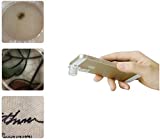 Supereyes Macro Lens-Disposable Dermatoscope| Smartphone 200x Magnifying Camera Attachment, Dermascope for iPhone, Samsung, Android/iOS| Dermatology Microscope, Universal Compatibility