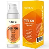 Cystic, Hormonal, and Severe Acne Treatment Cream for Teens & Adults Acne Treatment with Special Anti Acne Ingredients designed in USA and formulated in Japan (100ml/3.38oz)